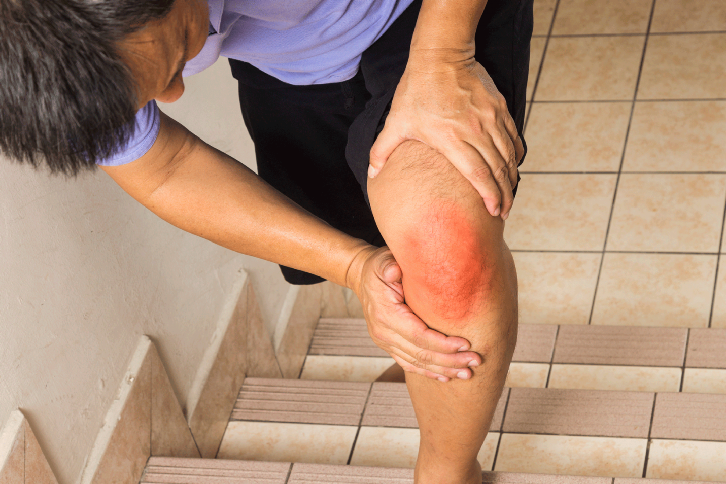 how to cure rheumatoid arthritis permanently